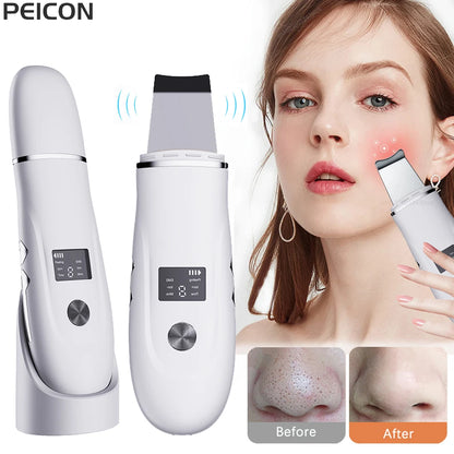 Ultrasonic Face Scrubber/ Peeling