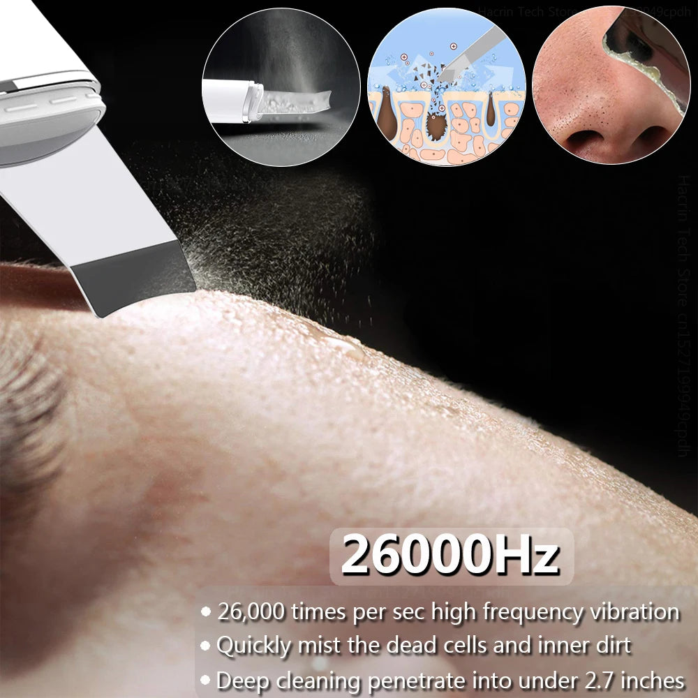 Ultrasonic Face Scrubber/ Peeling